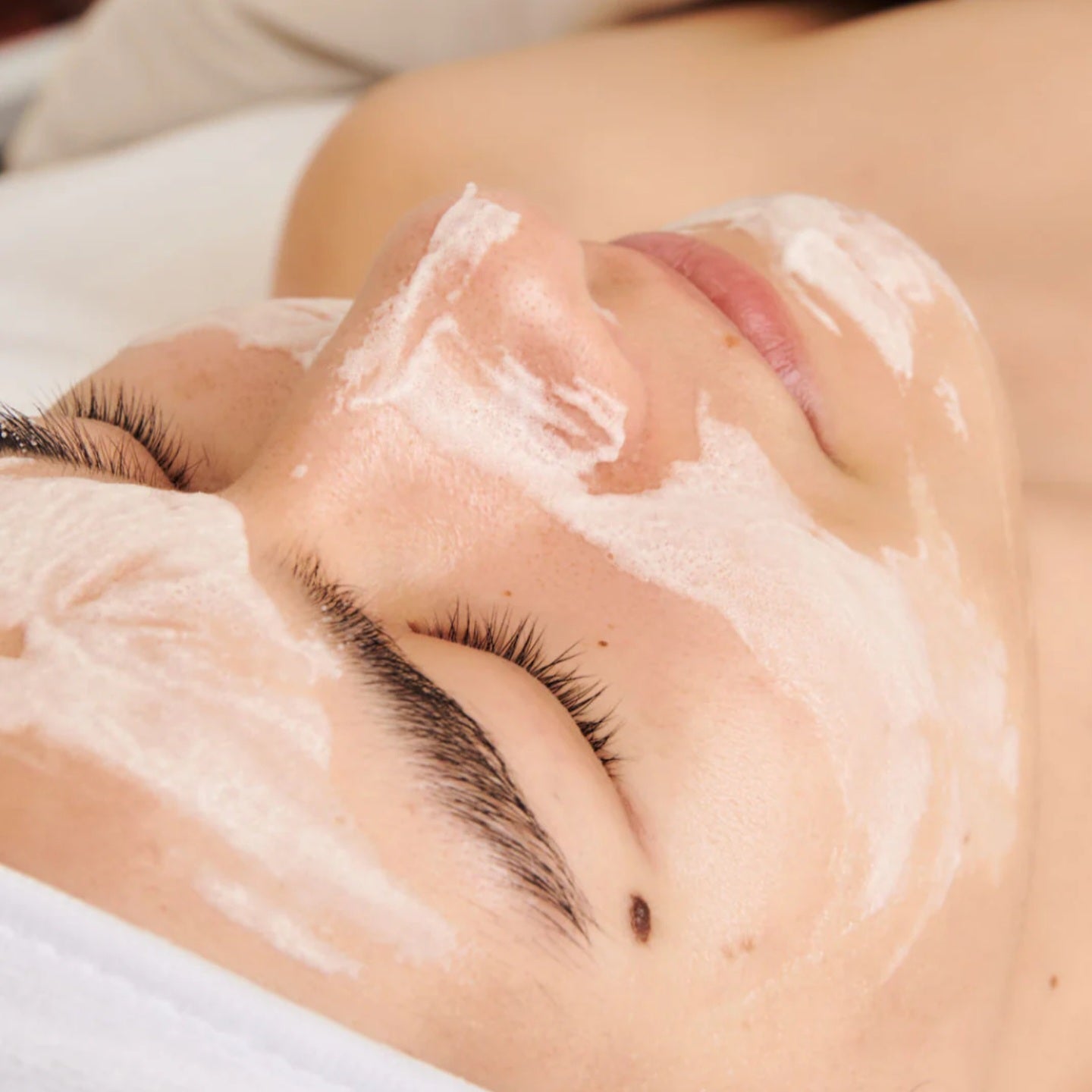 Dermathod O2 Tox Peel (Spicule Treatment)