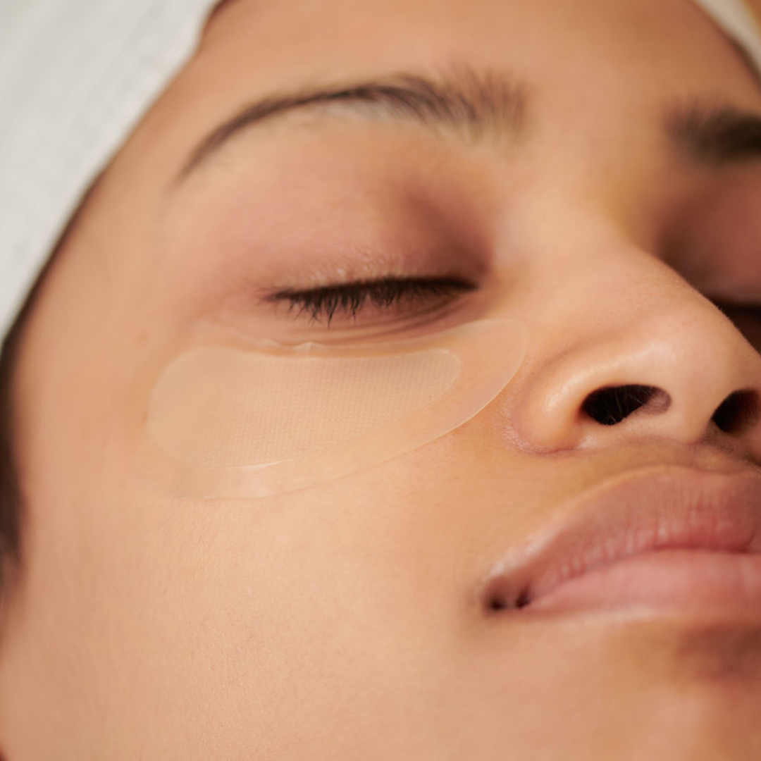 KrX Aesthetics Undereye Microchanneling Treatment